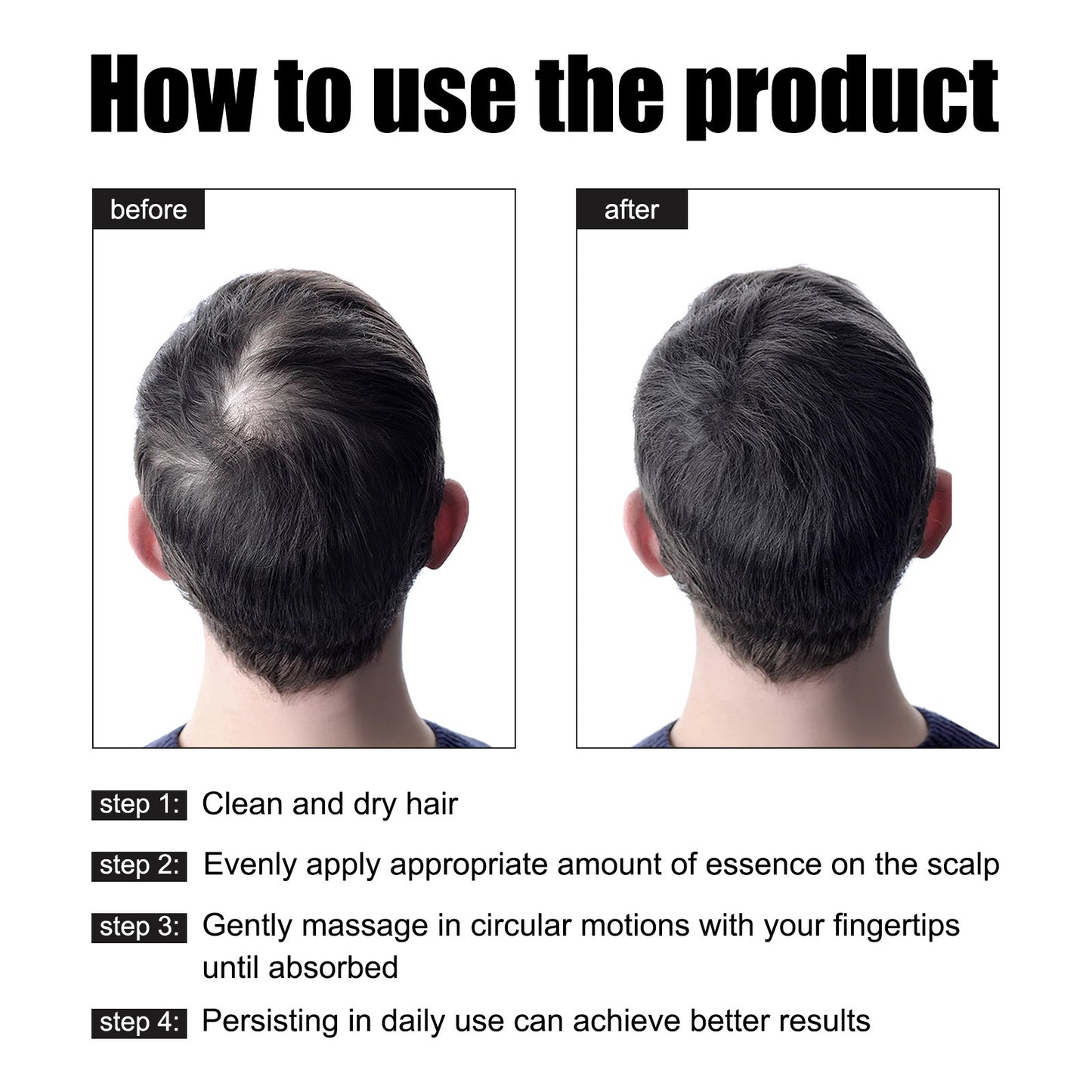 Huile  Essence barbe et perte de cheveux pour Homme a forte croissance