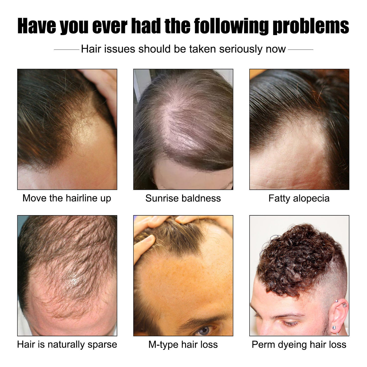 Huile  Essence barbe et perte de cheveux pour Homme a forte croissance