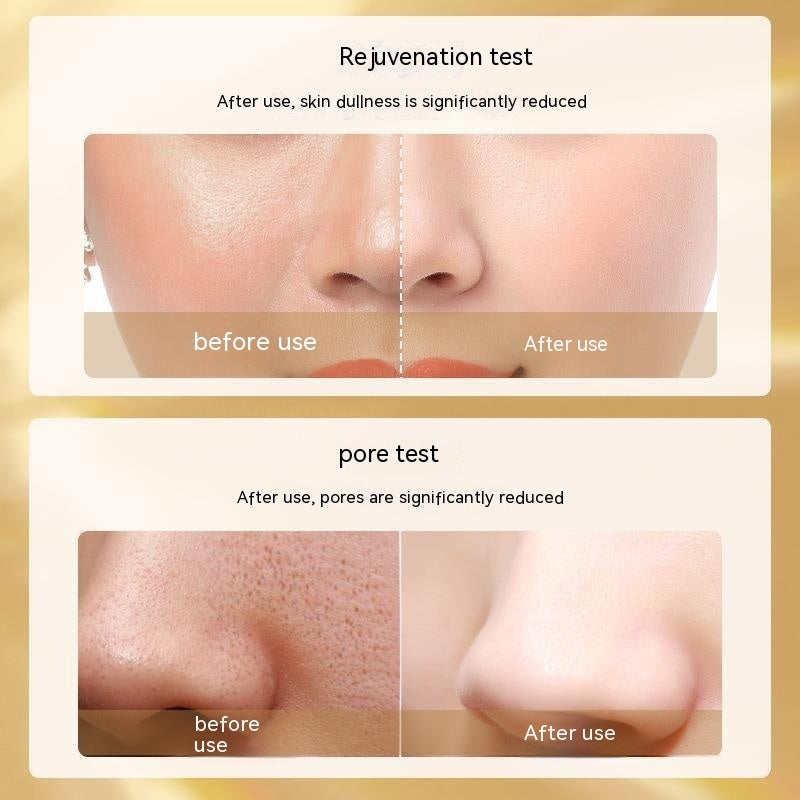 Ensemble de cinq pièces de luxe de couleur de verre Mylinsha pour le rajeunissement de la peau