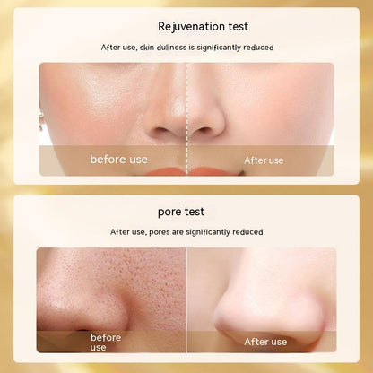 Ensemble de cinq pièces de luxe de couleur de verre Mylinsha pour le rajeunissement de la peau