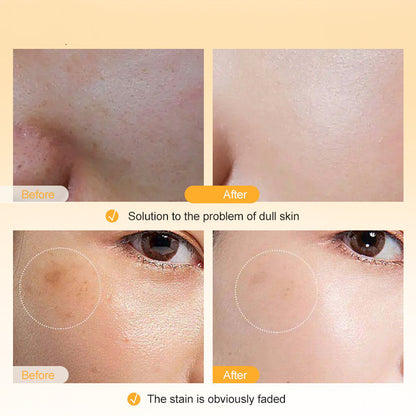 Vitamine C Lotion pour le visage Soins de la peau